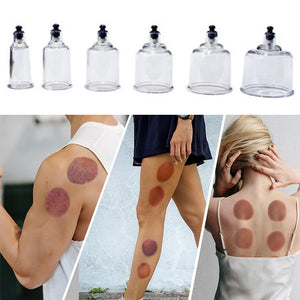 Professional Vacuum Cupping Therapy Set