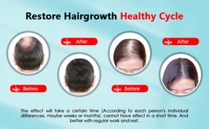 Red Light Therapy for Hair and Head